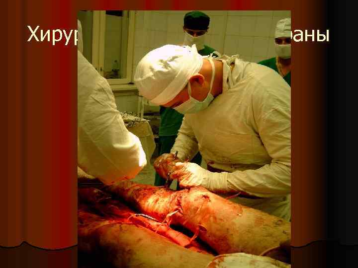 Хирургическая обработка раны 