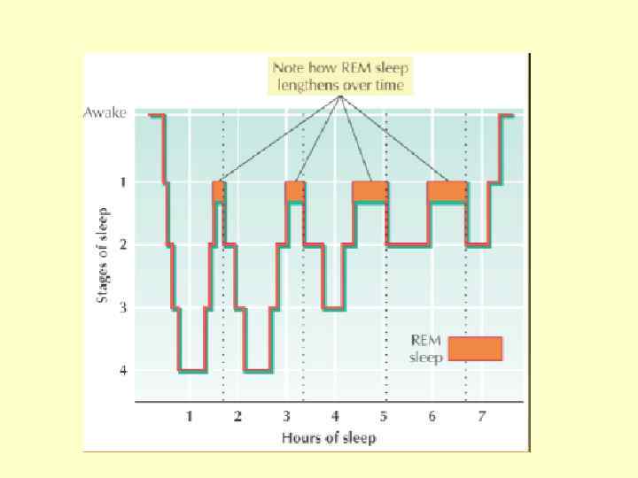 Rem фаза сна это. Rem фаза сна. Stages of Sleep диаграмма. Виды сна Rem. Описание Rem сна.