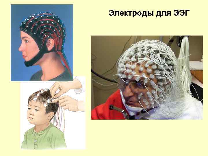 Электроды для ЭЭГ 