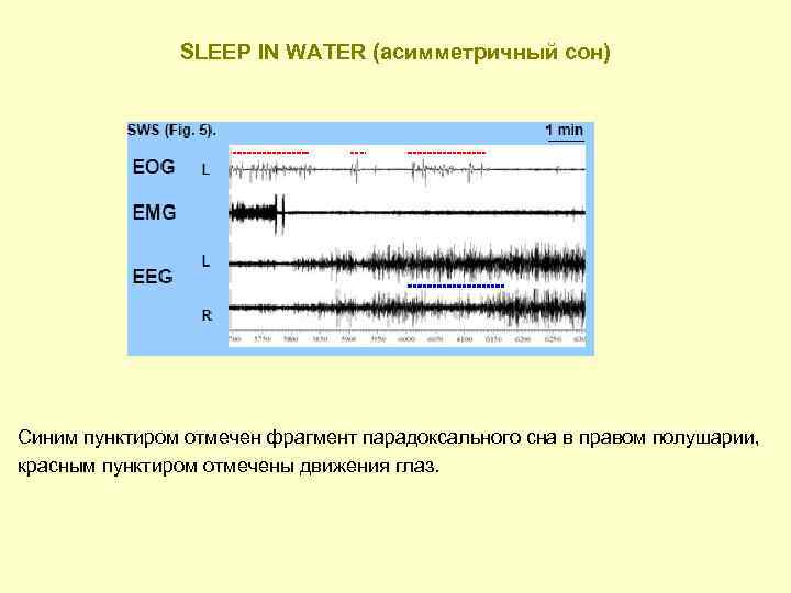 SLEEP IN WATER (асимметричный сон) Синим пунктиром отмечен фрагмент парадоксального сна в правом полушарии,