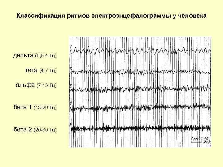 Классификация ритмов электроэнцефалограммы у человека дельта (0, 5 -4 Гц) тета (4 -7 Гц)