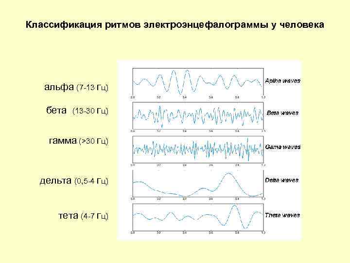 Классификация ритмов электроэнцефалограммы у человека альфа (7 -13 Гц) бета (13 -30 Гц) гамма