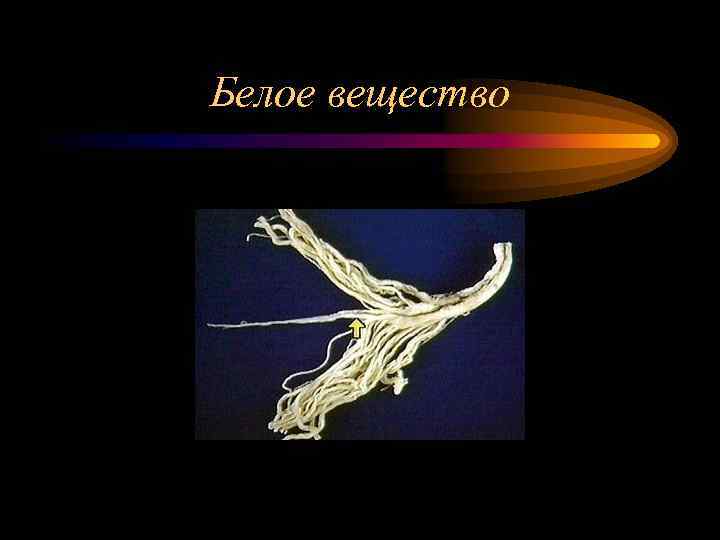 Белое вещество 
