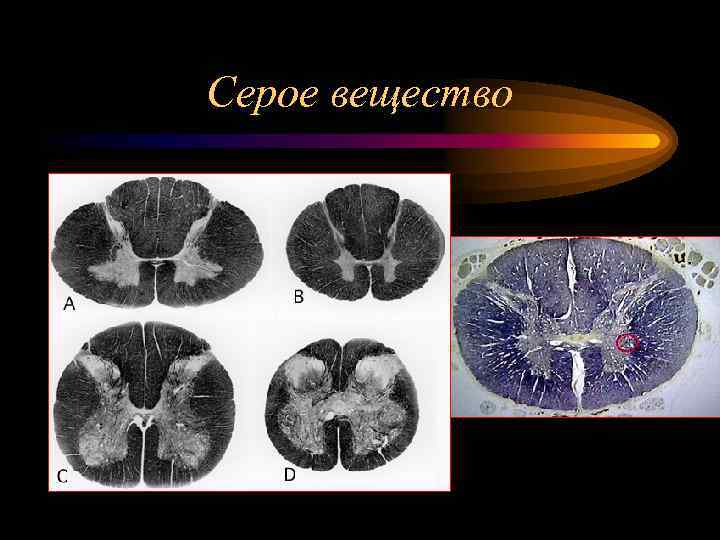 Серое вещество 
