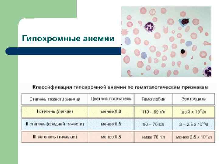 Гипохромные анемии 