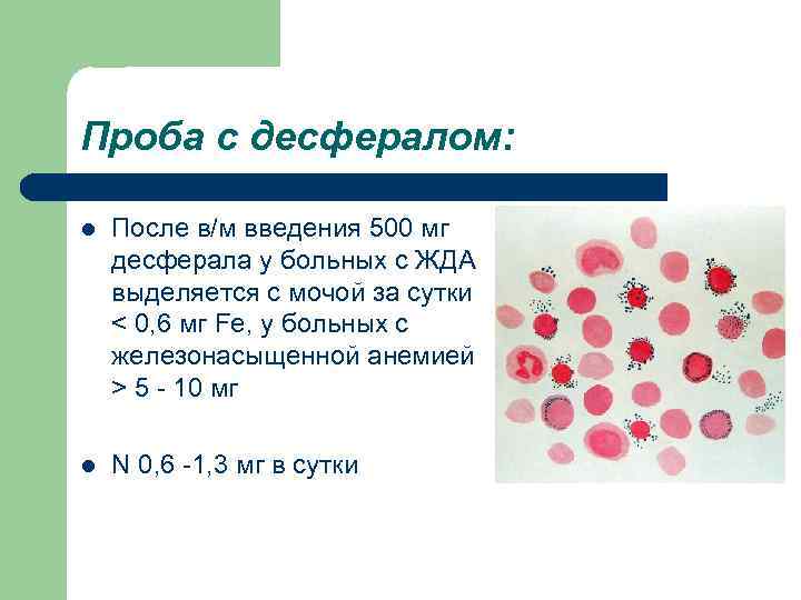 Проба с десфералом: l После в/м введения 500 мг десферала у больных с ЖДА