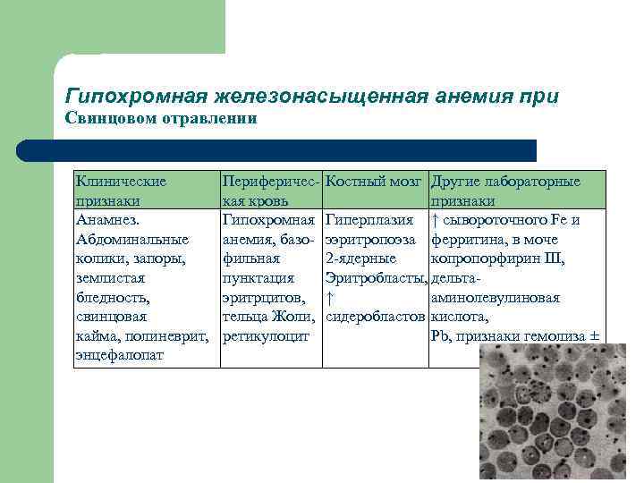 Анемия при свинцовой интоксикации