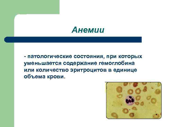 Анемии - патологические состояния, при которых уменьшается содержание гемоглобина или количество эритроцитов в единице