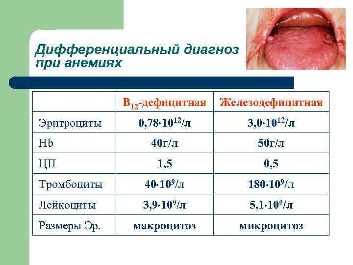 Дифференциальный диагноз при анемиях В 12 -дефицитная Железодефицитная 0, 78 1012/л 3, 0 1012/л