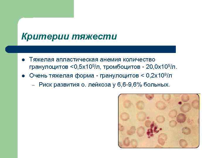 Критерии тяжести l l Тяжелая апластическая анемия количество гранулоцитов <0, 5 x 109/л, тромбоцитов