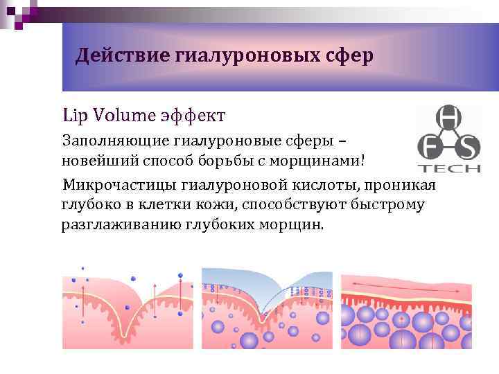 Действие гиалуроновых сфер Lip Volume эффект Заполняющие гиалуроновые сферы – новейший способ борьбы с