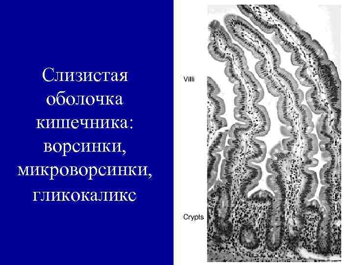 Слизистая оболочка кишечника. Микроворсинки слизистой оболочки кишечника. Гликокаликс тонкого кишечника. Гликокаликс кишечник.