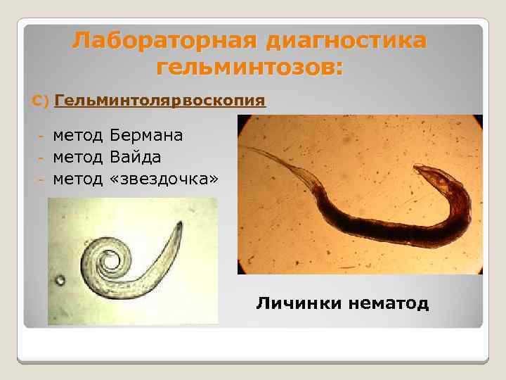 Лабораторная диагностика гельминтозов: С) Гельминтолярвоскопия метод Бермана - метод Вайда - метод «звездочка» -