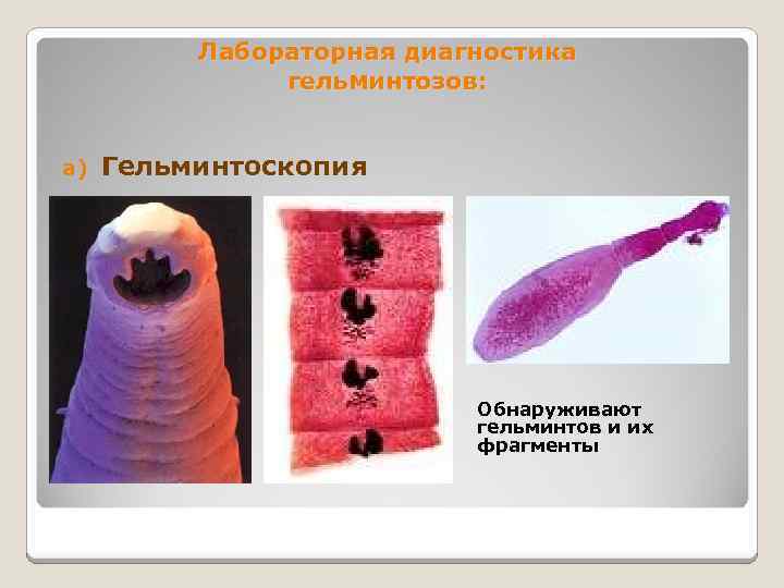 Лабораторная диагностика гельминтозов: a) Гельминтоскопия Обнаруживают гельминтов и их фрагменты 