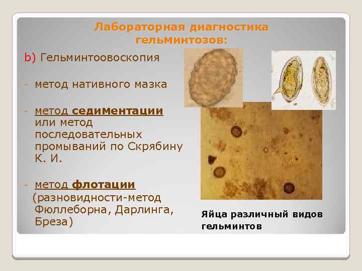 Лабораторная диагностика гельминтозов: b) Гельминтоовоскопия - метод нативного мазка - метод седиментации или метод