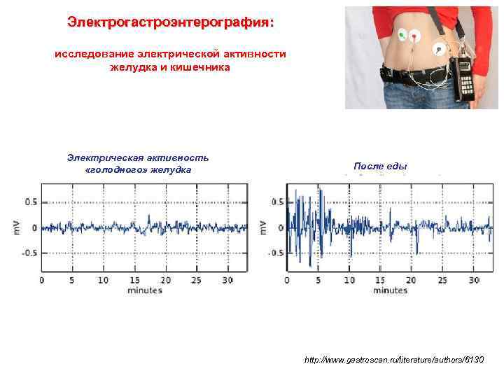 Электрогастроэнтерография: исследование электрической активности желудка и кишечника Электрическая активность «голодного» желудка После еды http: