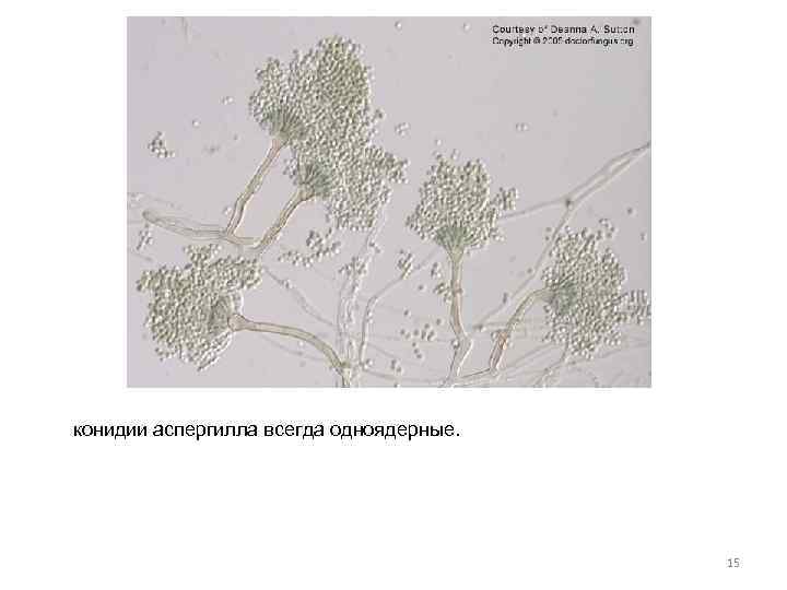 конидии аспергилла всегда одноядерные. 15 