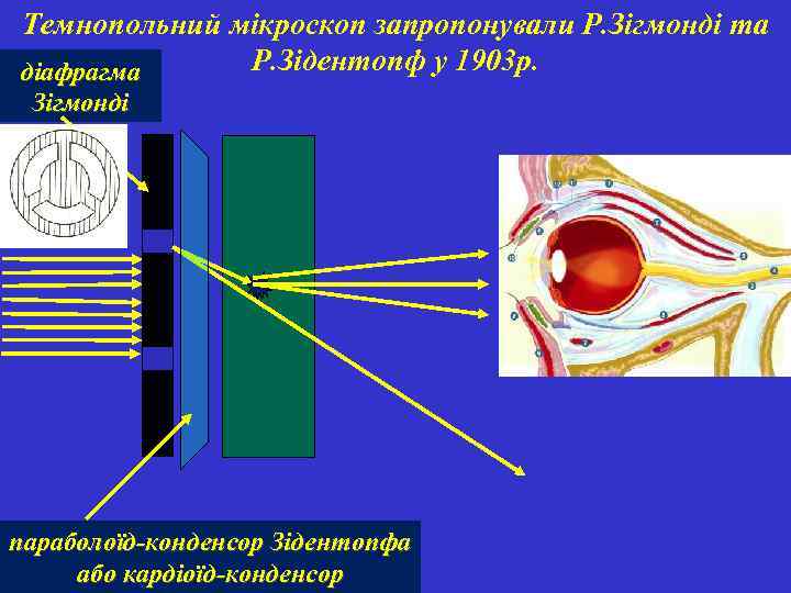 Темнопольний мікроскоп запропонували Р. Зігмонді та Р. Зідентопф у 1903 р. діафрагма Зігмонді параболоїд-конденсор