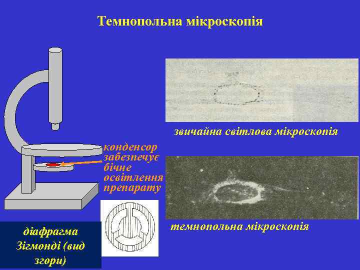 Темнопольна мікроскопія звичайна світлова мікроскопія конденсор забезпечує бічне освітлення препарату діафрагма Зігмонді (вид згори)