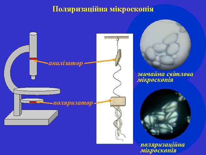 Поляризаційна мікроскопія аналізатор звичайна світлова мікроскопія поляризатор поляризаційна мікроскопія 