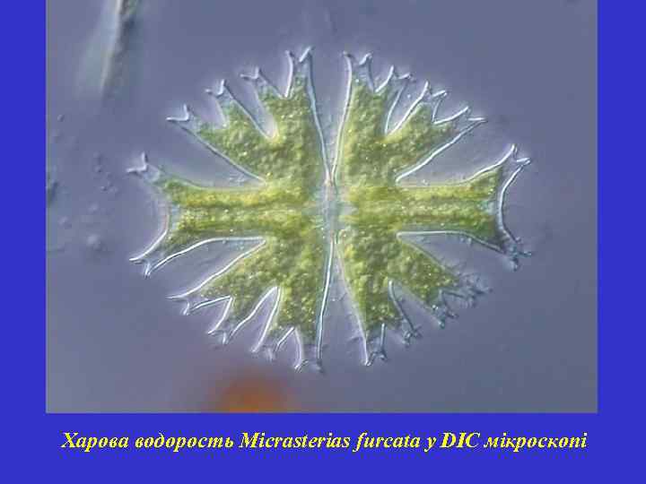 Харова водорость Micrasterias furcata у DIC мікроскопі 