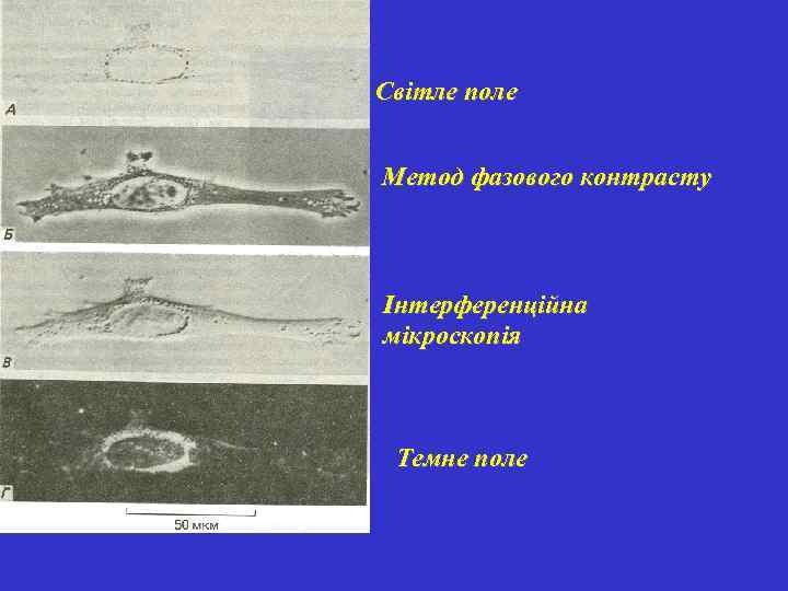 Світле поле Метод фазового контрасту Інтерференційна мікроскопія Темне поле 
