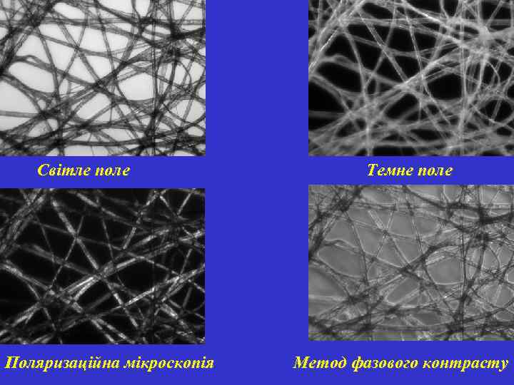 Світле поле Поляризаційна мікроскопія Темне поле Метод фазового контрасту 