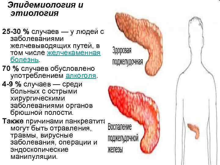 Синдром острого живота у детей презентация thumbnail