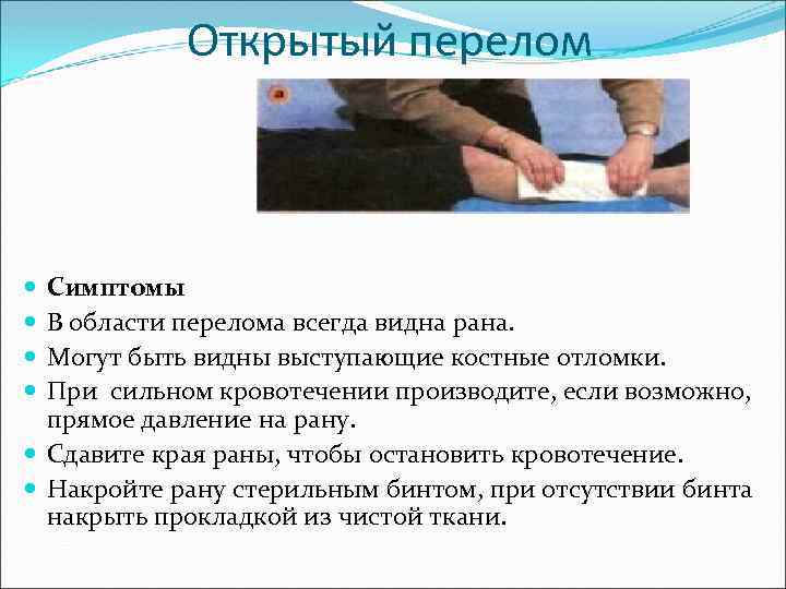 Открытый перелом Симптомы В области перелома всегда видна рана. Могут быть видны выступающие костные