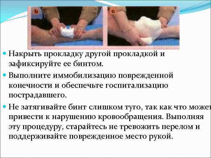  Накрыть прокладку другой прокладкой и зафиксируйте ее бинтом. Выполните иммобилизацию поврежденной конечности и