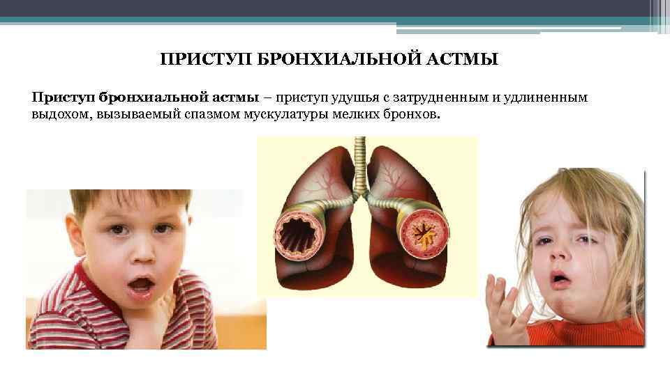 ПРИСТУП БРОНХИАЛЬНОЙ АСТМЫ Приступ бронхиальной астмы – приступ удушья с затрудненным и удлиненным выдохом,
