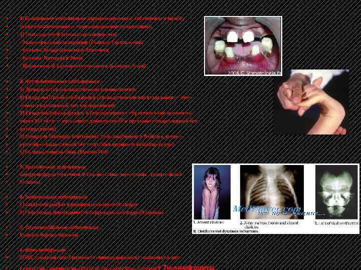  • • 1. Системные заболевания (промежуточны е заболевани я межд у гиперпластическими и