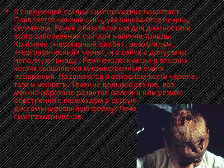  • В следующей стадии симптоматика нарастает. Появляется кожная сыпь, увеличиваются печень, селезенка. Ранее