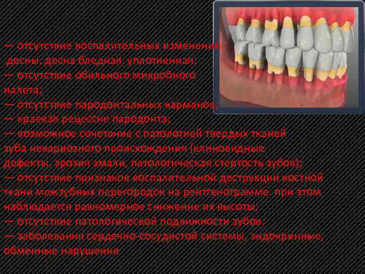 — отсутствие воспалительных изменений десны, десна бледная, уплотненная; — отсутствие обильного микробного налета; —
