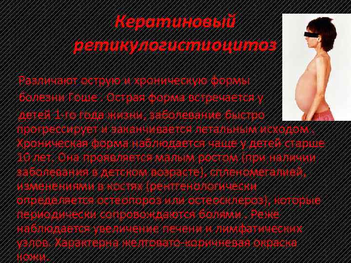 Кератиновый ретикулогистиоцитоз Различают острую и хроническую формы болезни Гоше. Острая форма встречается у детей