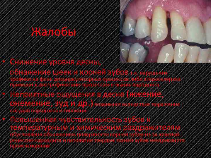 Жалобы • Снижение уровня десны, обнажение шеек и корней зубов т. к. нарушения трофики