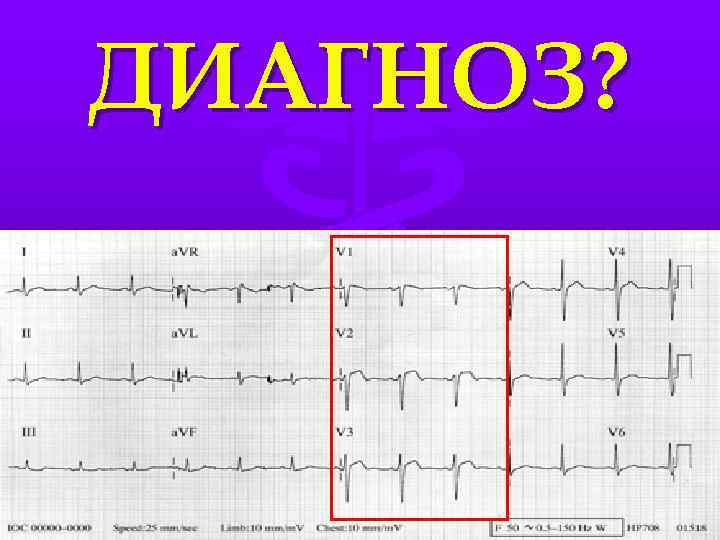 ДИАГНОЗ? 