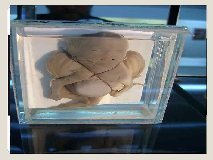 Ужас. Последствия алкоголизма и наркомании при рождении ребенка 