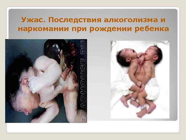 Ужас. Последствия алкоголизма и наркомании при рождении ребенка 
