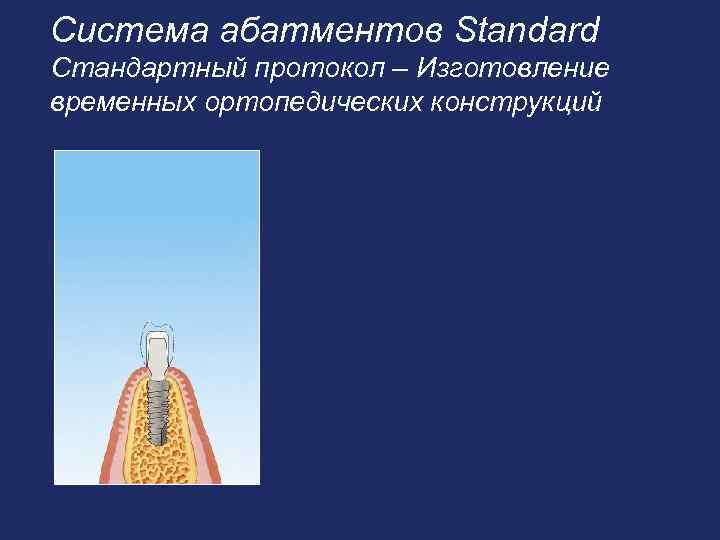 Система абатментов Standard Стандартный протокол – Изготовление временных ортопедических конструкций 