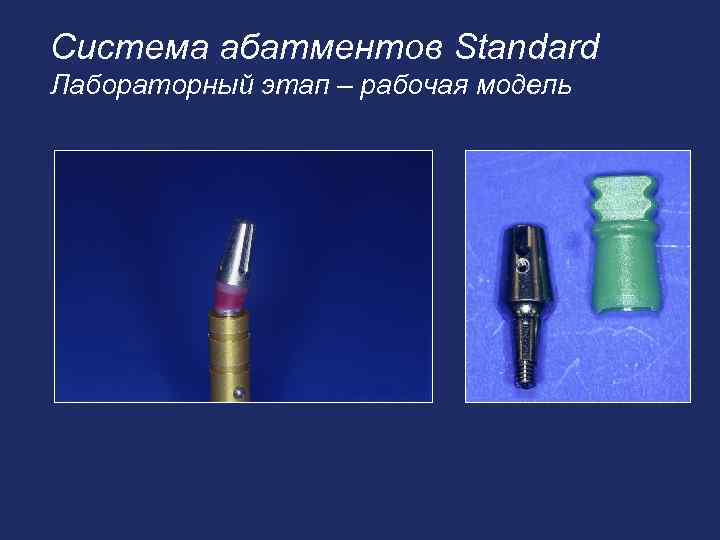 Система абатментов Standard Лабораторный этап – рабочая модель 