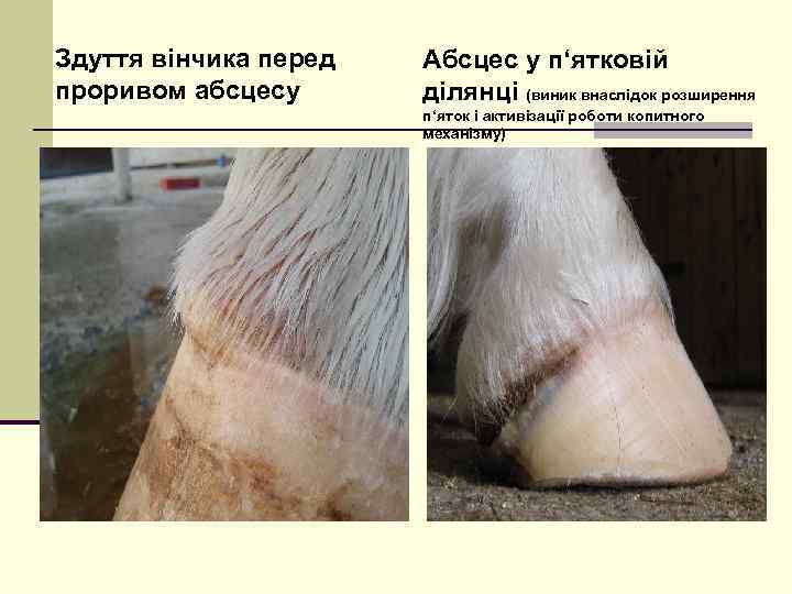 Здуття вінчика перед проривом абсцесу Абсцес у п‘ятковій ділянці (виник внаслідок розширення п‘яток і