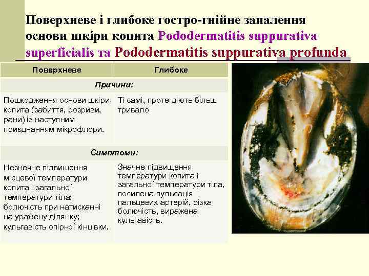 Поверхневе і глибоке гостро-гнійне запалення основи шкіри копита Pododermatitis suppurativa superficialis та Pododermatitis suppurativa