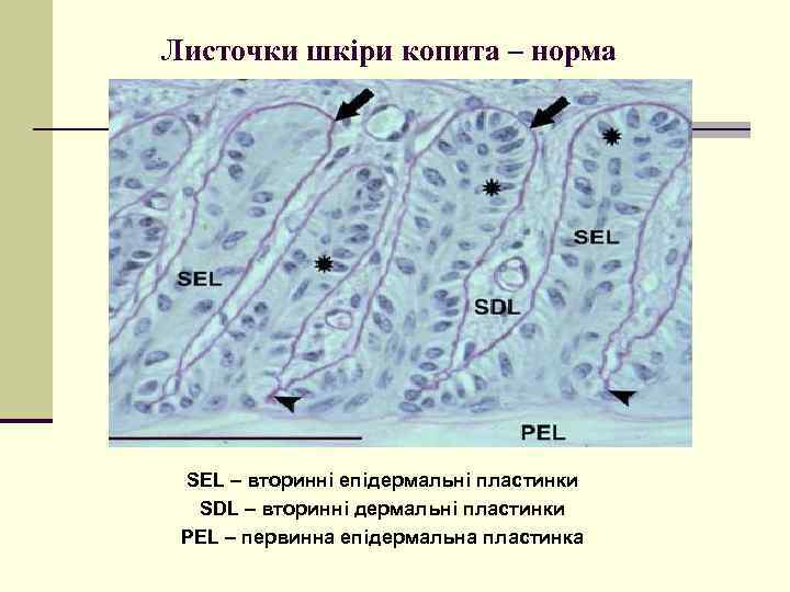 Листочки шкіри копита – норма SEL – вторинні епідермальні пластинки SDL – вторинні дермальні