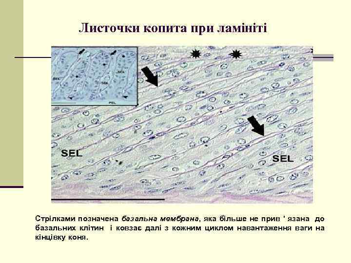 Листочки копита при ламініті Стрілками позначена базальна мембрана, яка більше не прив ' язана