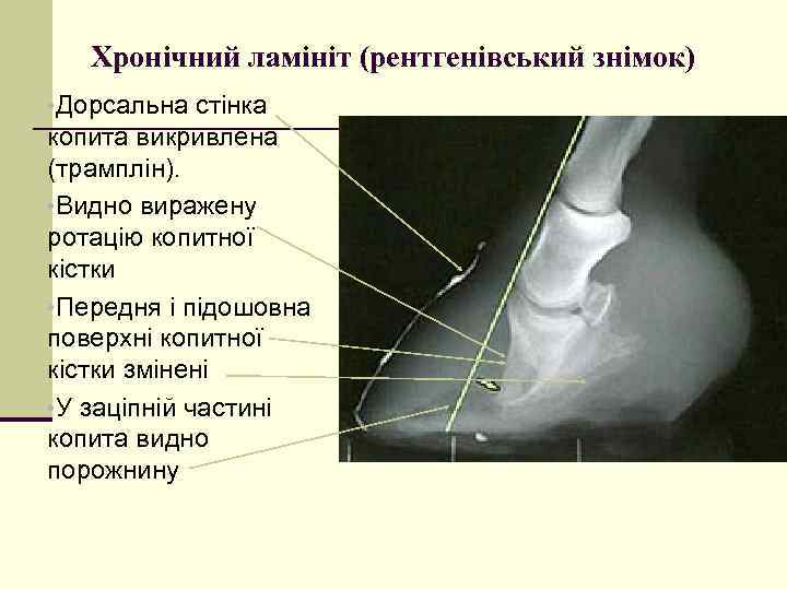 Хронічний ламініт (рентгенівський знімок) • Дорсальна стінка копита викривлена (трамплін). • Видно виражену ротацію
