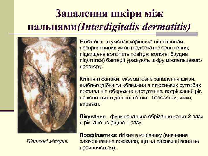 Запалення шкіри між пальцями(Interdigitalis dermatitis) Етіологія: в умовах корівника під впливом несприятливих умов (недостатнє