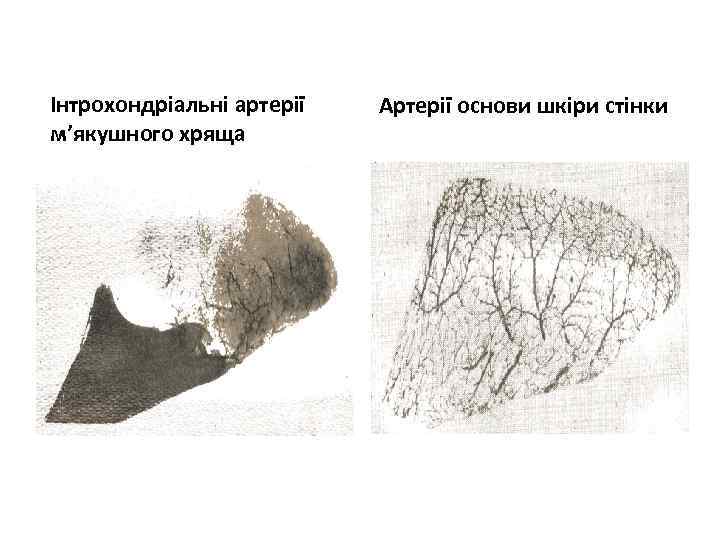 Інтрохондріальні артерії м’якушного хряща Артерії основи шкіри стінки 