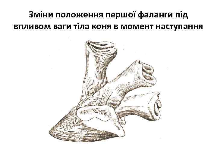 Зміни положення першої фаланги під впливом ваги тіла коня в момент наступання 