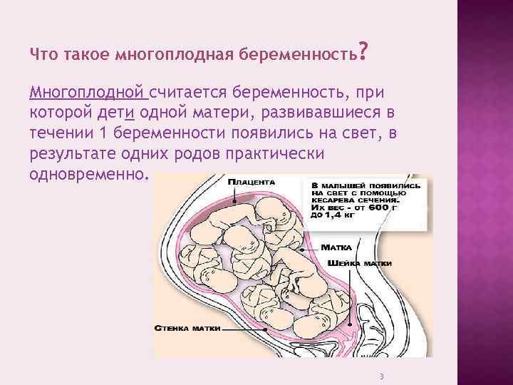 Что такое многоплодная беременность? Многоплодной считается беременность, при которой дети одной матери, развивавшиеся в